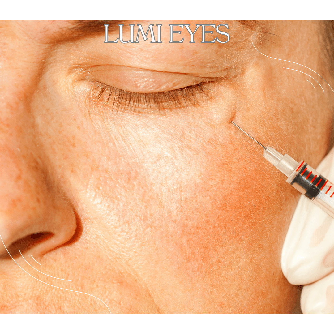 Lumi Eyes is an advanced under-eye treatment that restores youthful radiance, hydrates the skin, and reduces dark circles and fine lines!