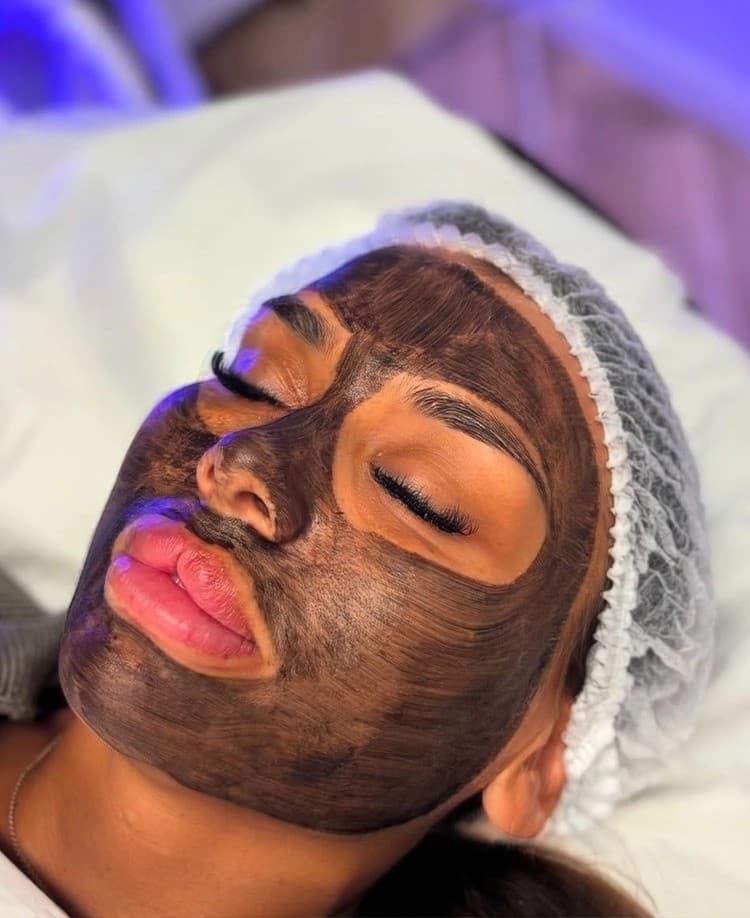 Carbon Laser Facial